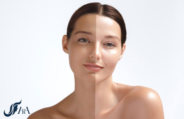 10 روش کلاژن سازی پوست در خانه