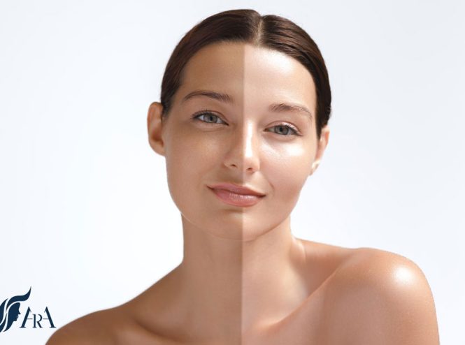 10 روش کلاژن سازی پوست در خانه