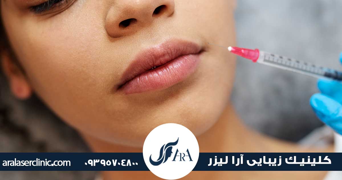 از بین بردن ژل لب