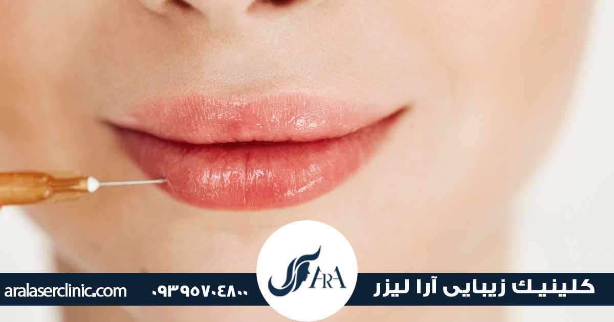 تخلیه فیلر لب