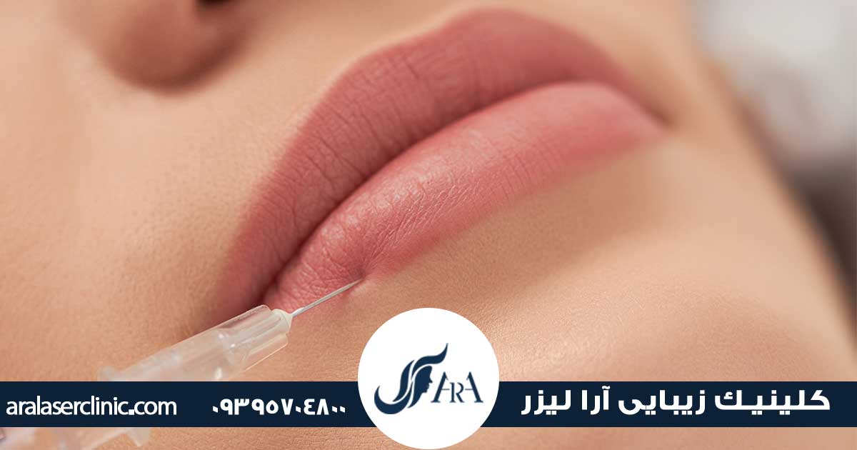 تخلیه ژل لب با سوزن