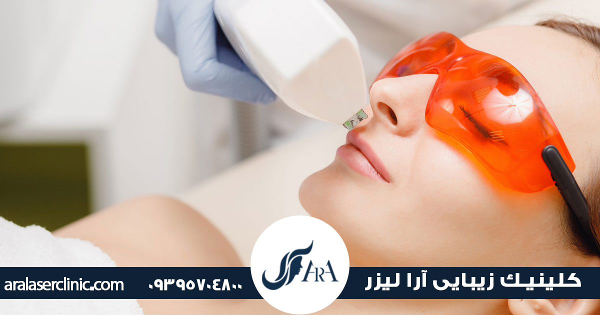 قیمت لیزر بانوان در فردیس