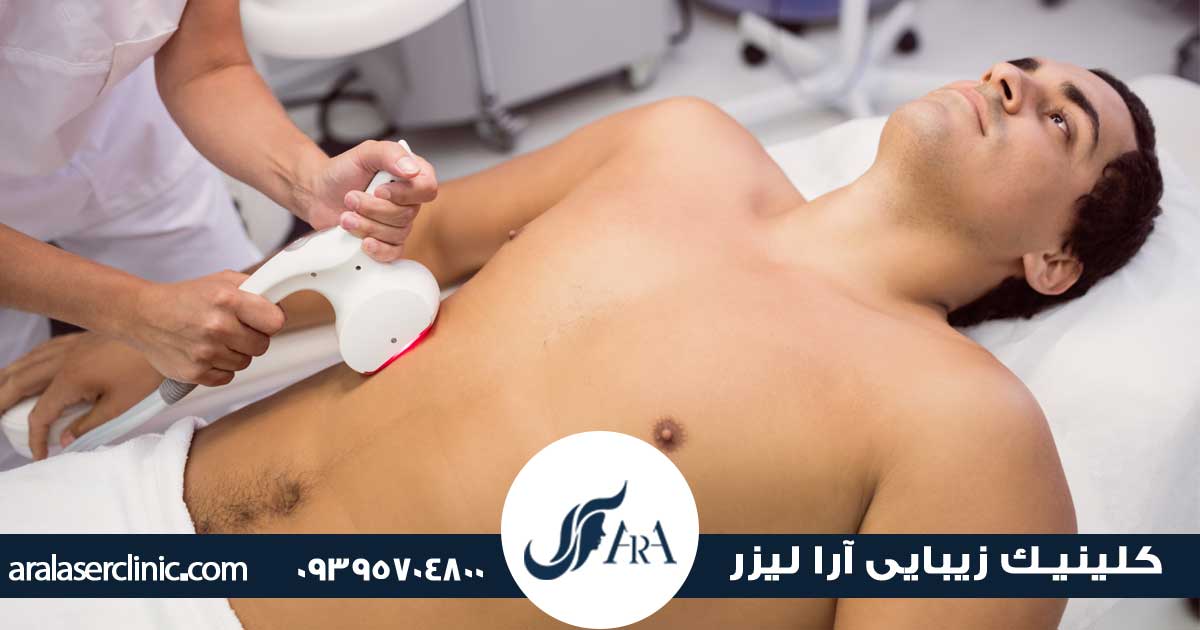 قیمت لیزر آقایان در فردیس