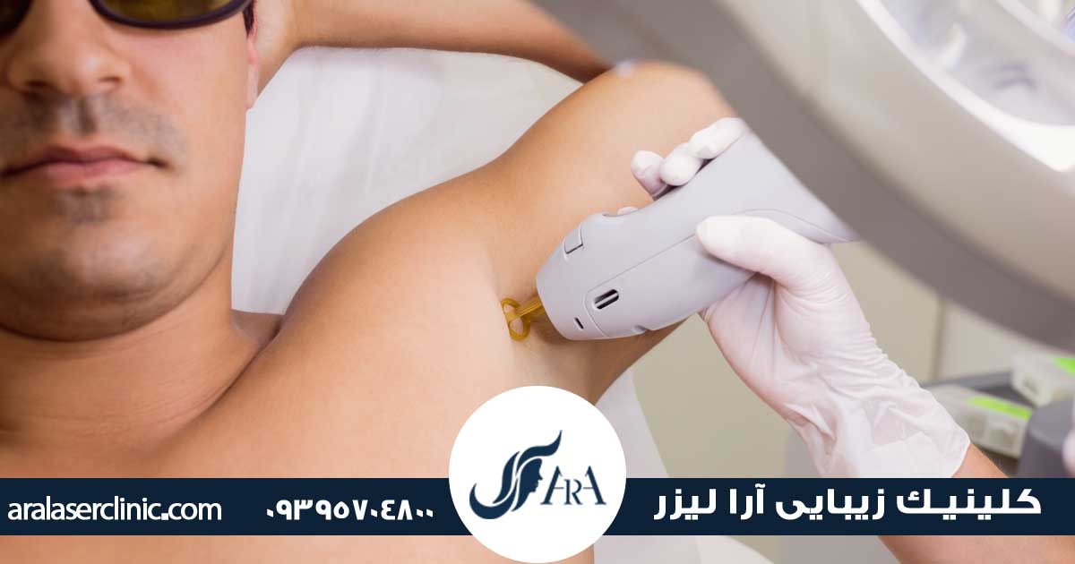 لیزر موهای زائد آقایان در فردیس