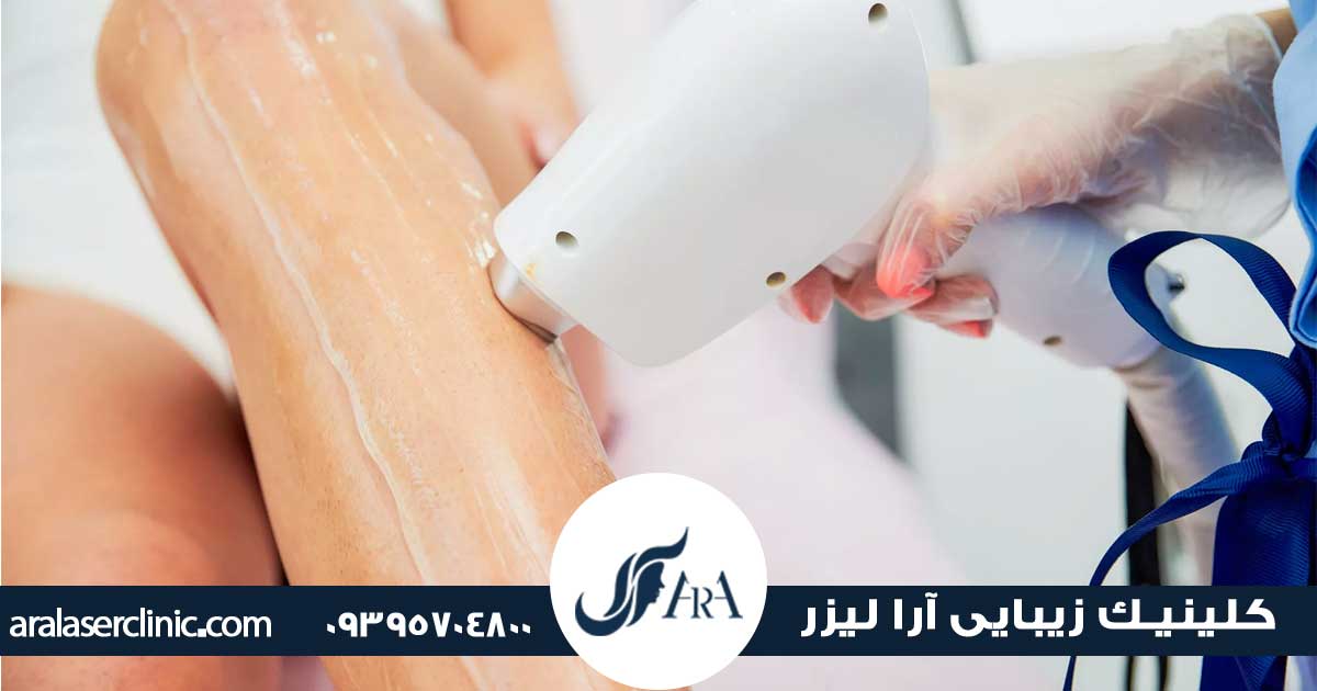 دستگاه لیزر الکساندرایت نابلکس در فردیس