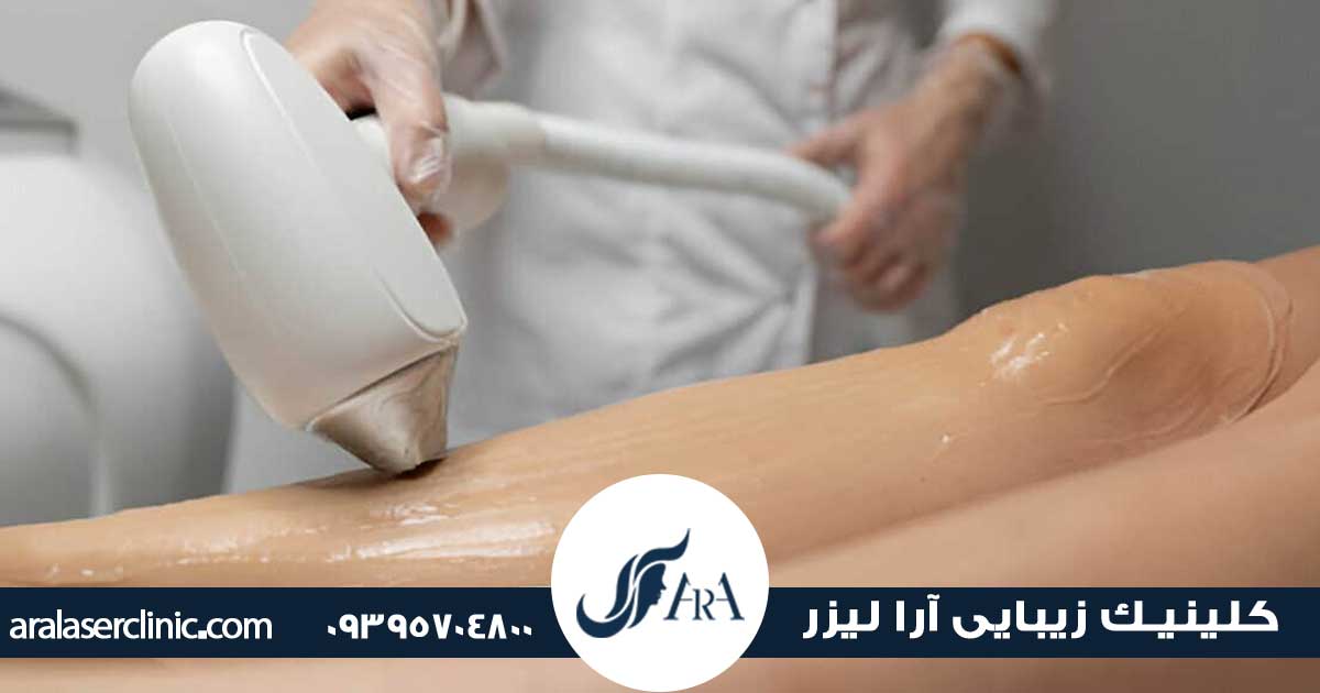 دستگاه لیزر رولی