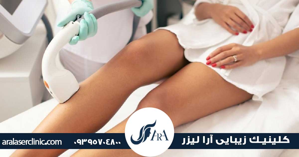 لیزر موهای زائد با دستگاه رولی