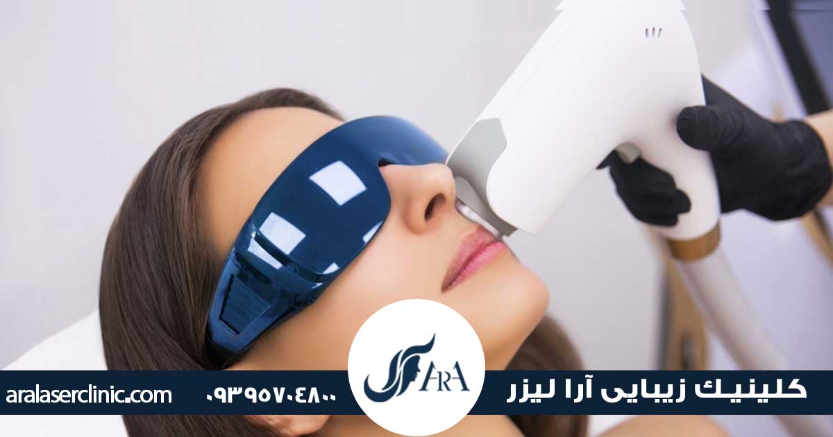 ماندگاری لیزر رولی